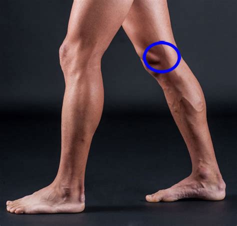 Причины болей при сгибании коленного сустава